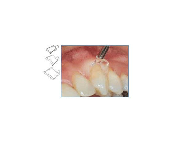 RETRACTORES GINGIVALES LM pequeños 60 ud