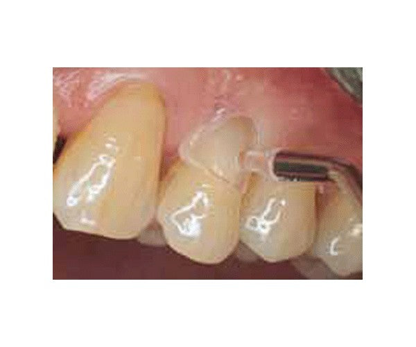 MATRICES CERVICALES LM p/caninos premolar 60 ud