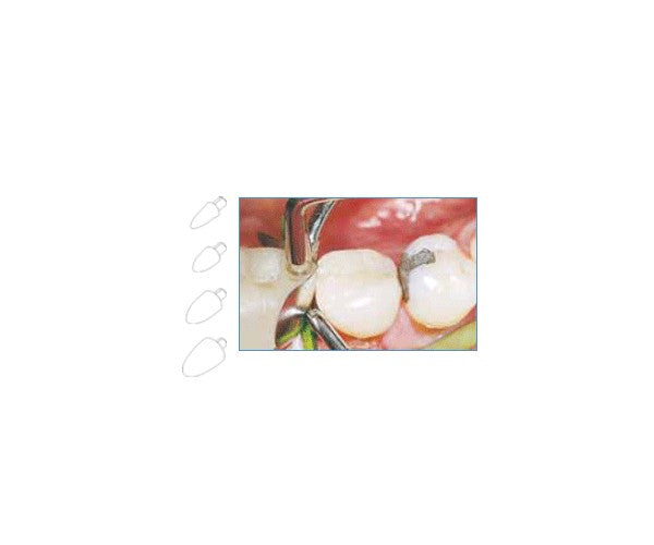 FORMADORES DE CONTACTO LM surtido 120 ud