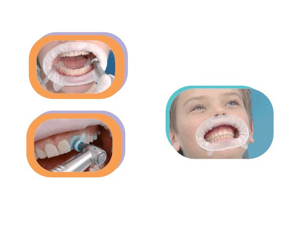 OPTRAGATE reposicion pequeño 80 ud