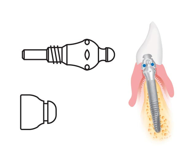 MICROPLANT KOMET 4305A.0 kit ancoratge anell