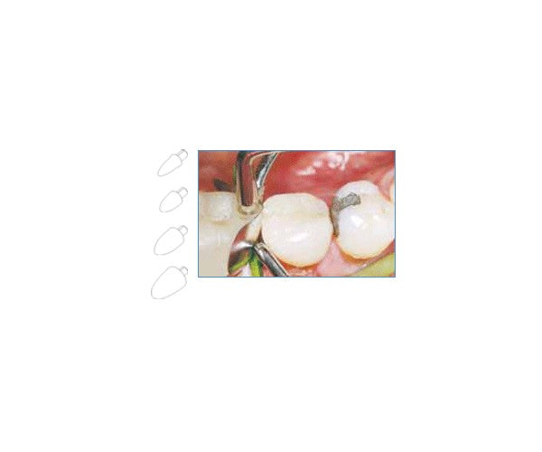 FORMADORES DE CONTACTO LM pequeños 60 ud