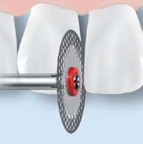 952.900.140  KOMET DISCOS   DIAMANTE  900 ø 140 GRANO ESTANDAR 1 ud.