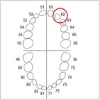 AK6ZE nº 62 1 ut