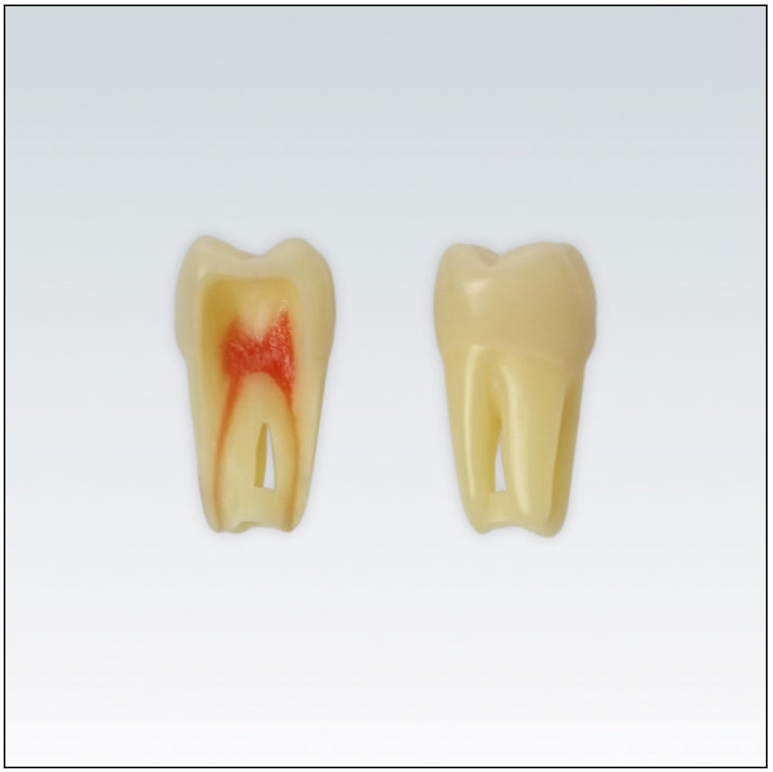ANA4Z3RN26 diente endo c/raiz natural, apto RX, 3 capas nº26