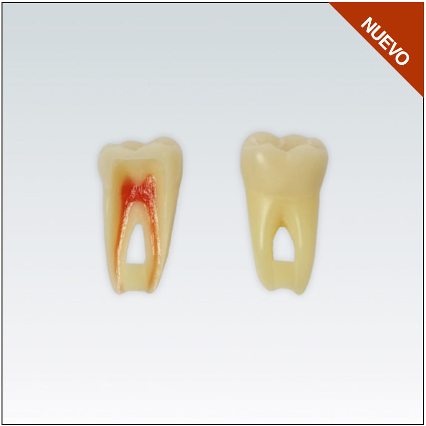 ANA4Z3RN36 diente endo c/raiz natural, apto RX, 3 capas nº36
