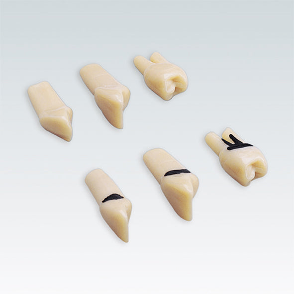 APZZEC1 nº 26 dientes especiales 1 raiz con sarro 1 ud