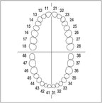 AEZME No. 16 single metal tooth CrNi