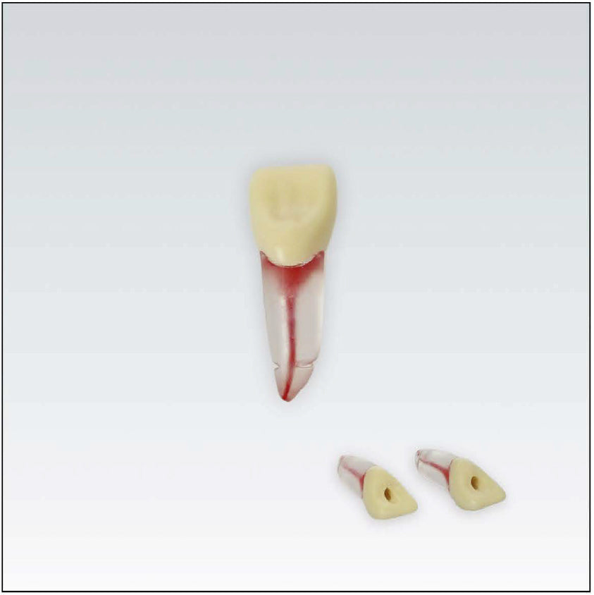 ANA4ZPUKNTT16 Diente endodoncia c/raiz natural transparente