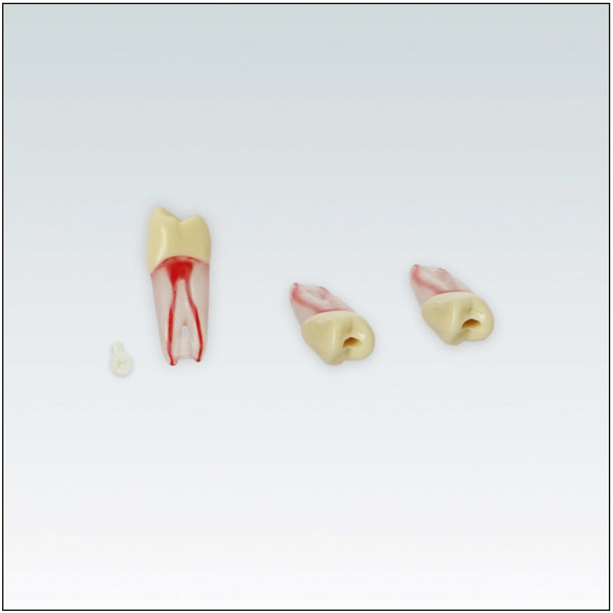 ANA4ZPUKN24 Diente endodoncia c/ raiz natural transparente