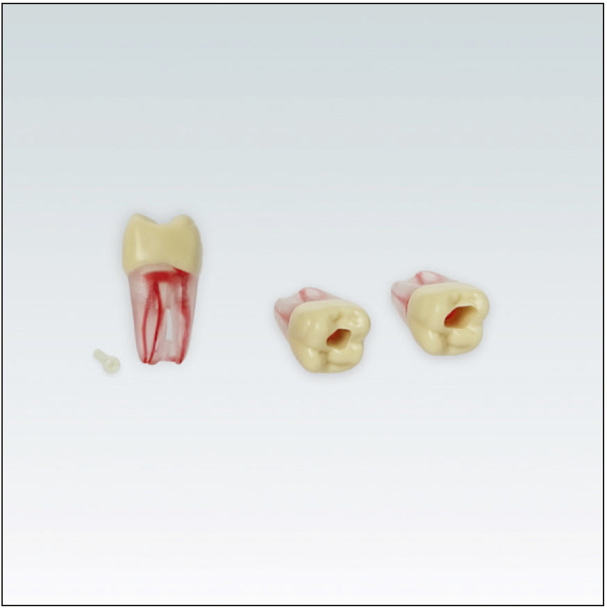 ANA4ZPUKN26 Endodontic tooth with transparent natural root