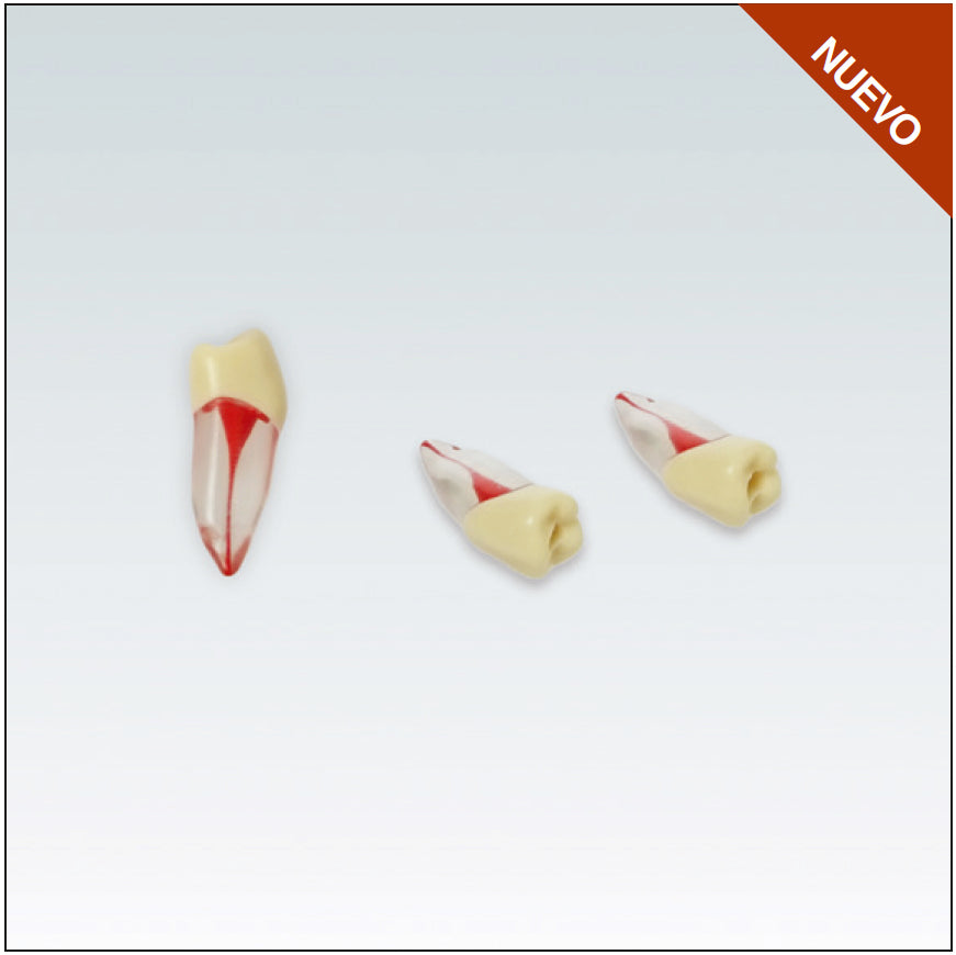 ANA4ZPUKN45 Diente endodoncia c/ raiz natural transparente