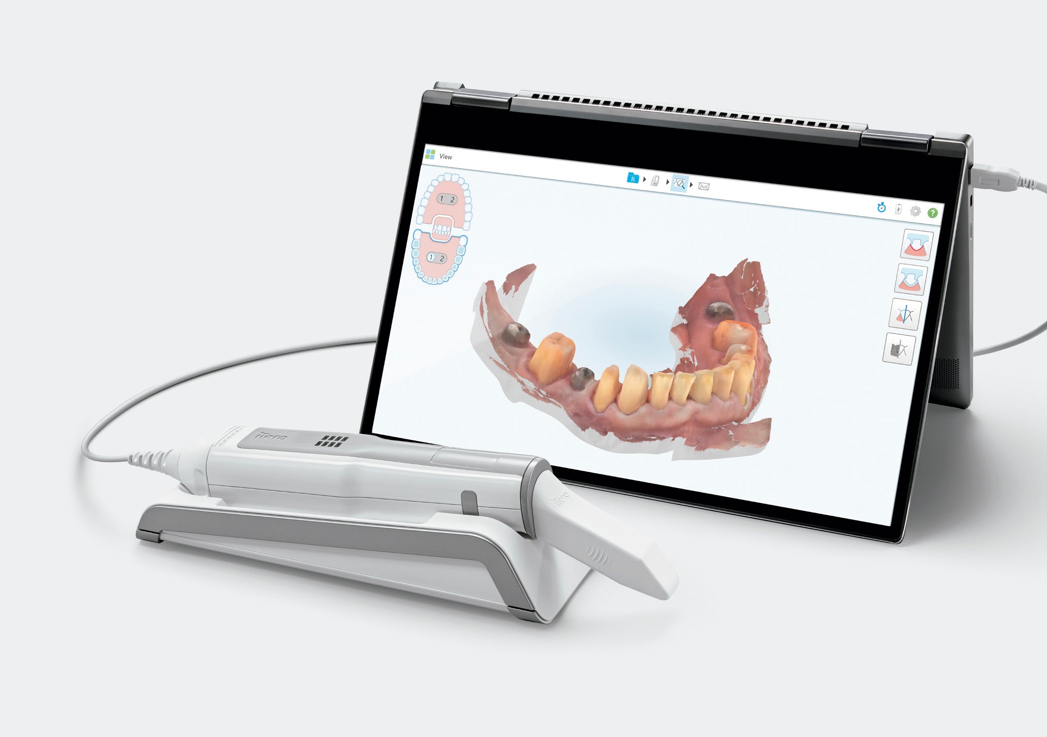 iTero 5D Laptop CPO 1 año servicio