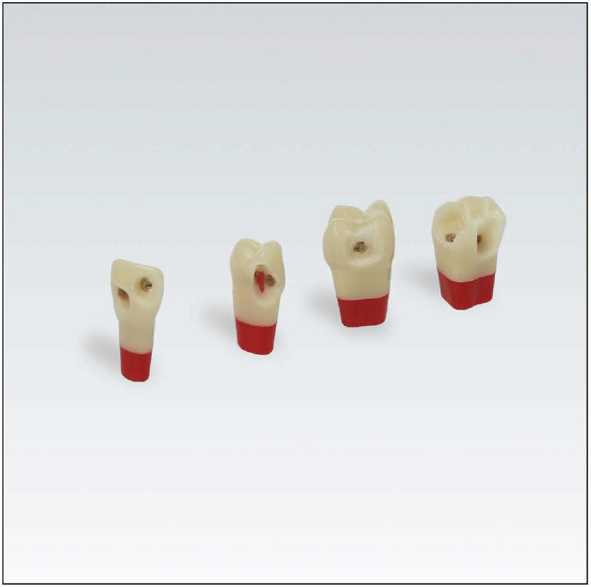ANA4ZSDPK 301 V1 Nº12 dent esmalt-dentina-polpa c/caries