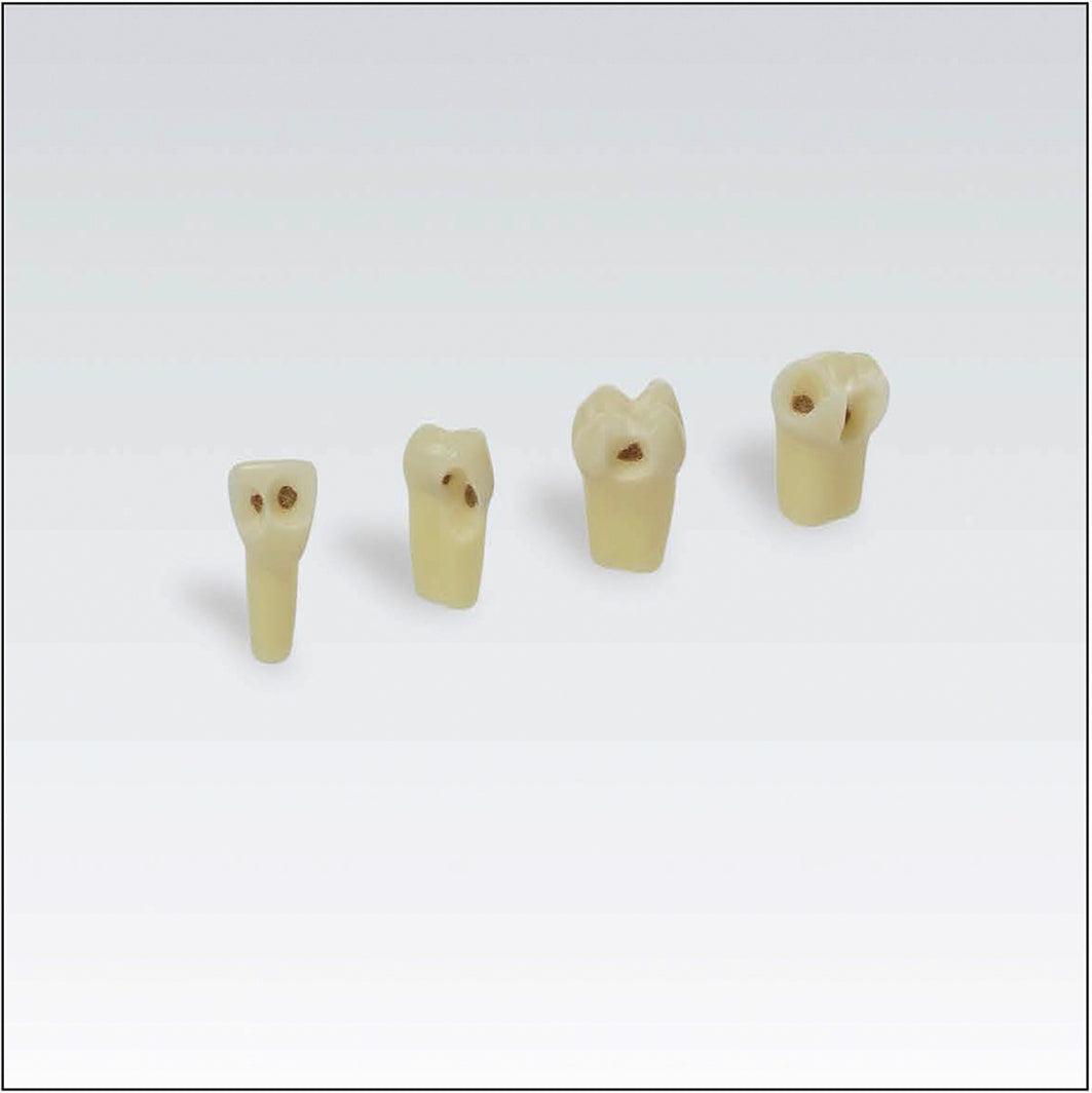 AG3ZSDK.301V1 21 diente c/esmalte, dentina c/caries