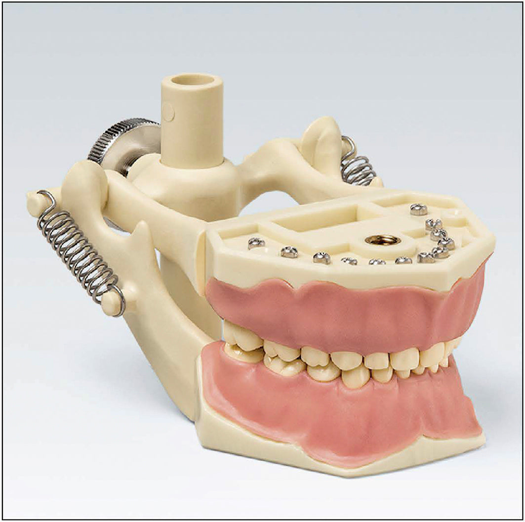 AK6/2DAK modelo infantil montado en articulador