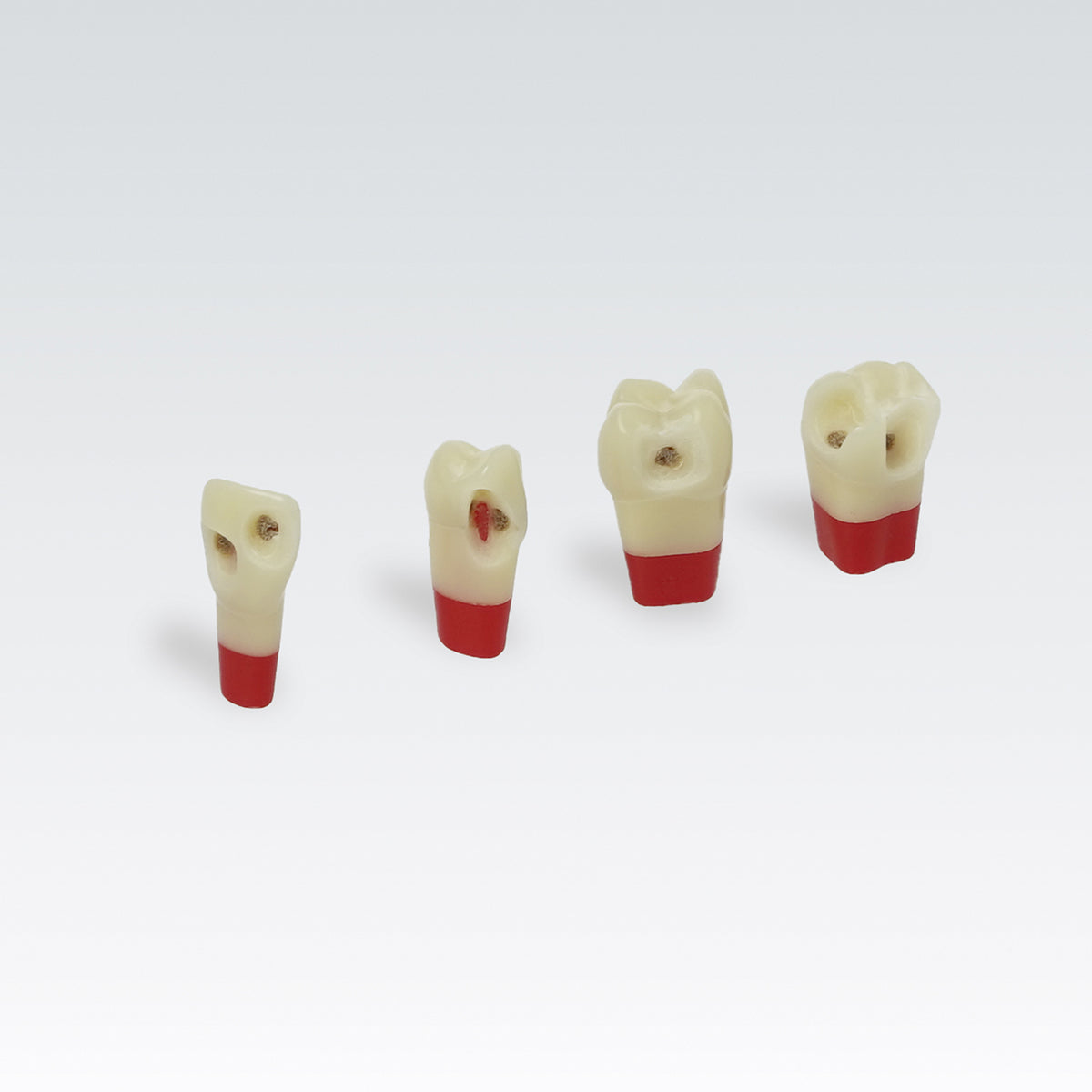 ANA4ZSDPK 301 V1 Nº13 diente esmalte-dentina-pulpa c/caries